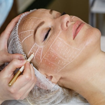 Facelift Treatment in Islamabad