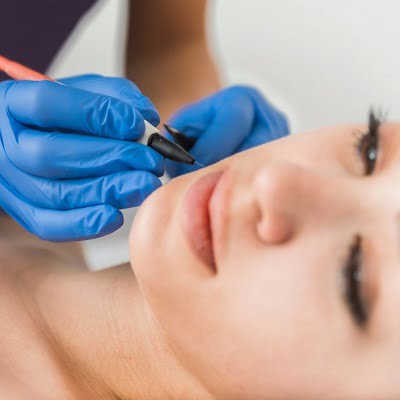 Best-Electrolysis-Hair-Removal-in-Islamabad