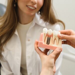 How To Choose a Dental Implant Specialist ?