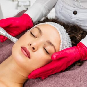 How to Choose the Right Microneedling Needle Size