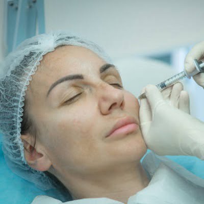 Cheek Fillers Injection in Islamabad