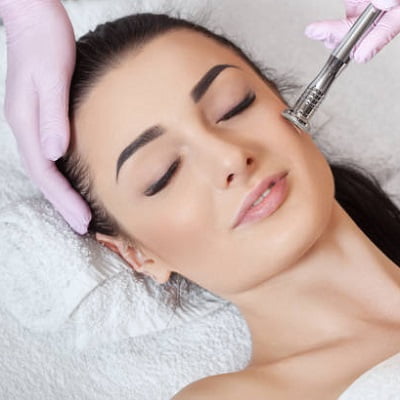 surgical acne scar treatment