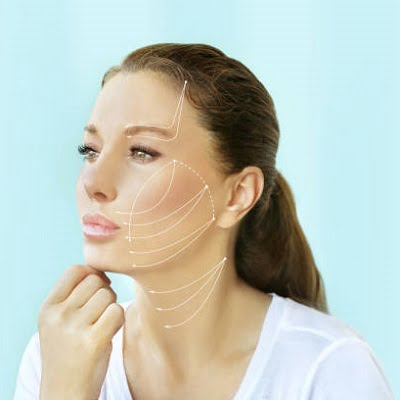 benefits of a silhouette facelift