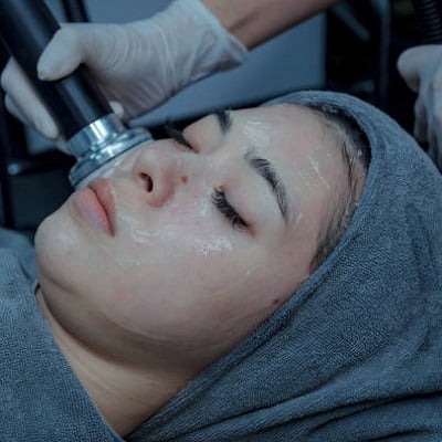 Achieve a radiant skin glow with chemical peel!