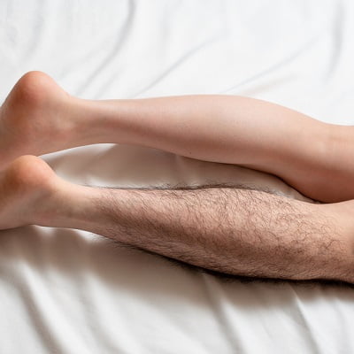 Half legs laser hair removal cost