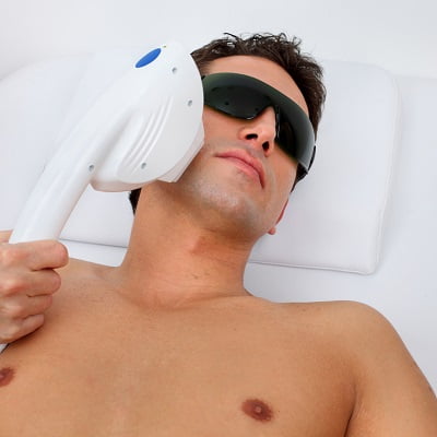 Who Should Not Get Laser Hair Removal