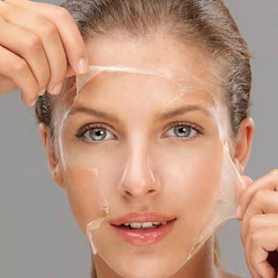 Chemical Skin Peel treatment Islamabad Pakistan