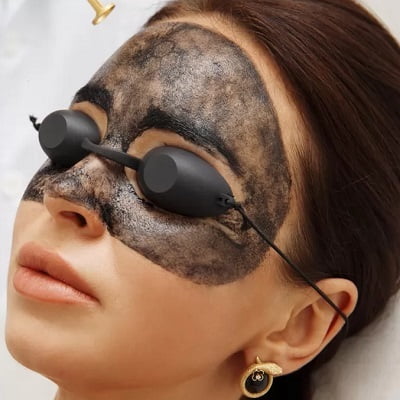 How Many Sessions of Laser Carbon Peel in Islamabad Is Required