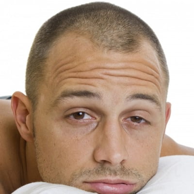 How to sleep after a hair transplant?