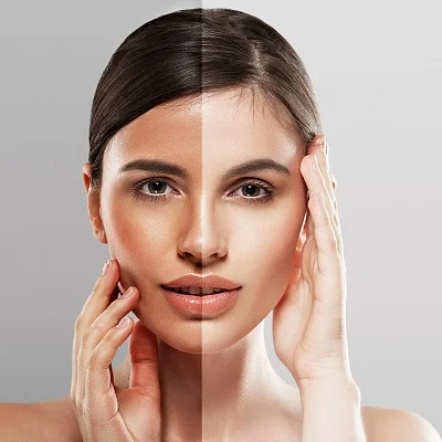 Most Common Skin Whitening Techniques in Islamabad