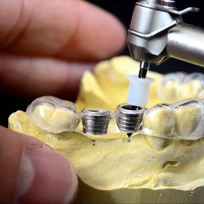 How long after a dental implant can you eat dairy?