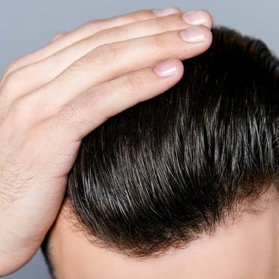 Is It Worth Going to Pakistan For A Hair Transplant?