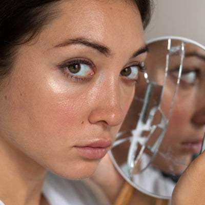 Can melasma treatments cause scarring