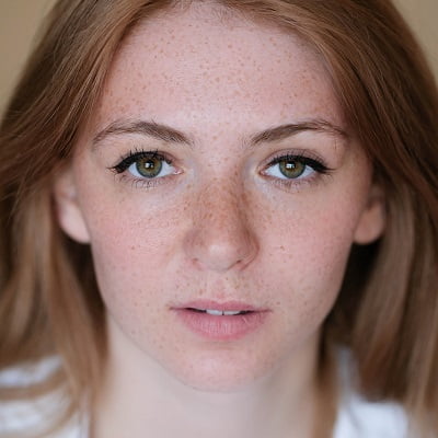 How do skin whitening treatments help with freckles?