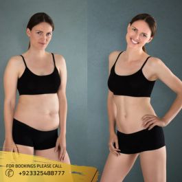 before after results of weight loss treatment