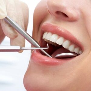 Permanent Tooth filling Cost in Pakistan