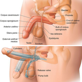 Erectile Dysfunction Treatment before after results